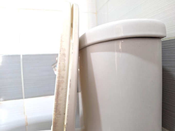 Sau một thời gian sử dụng, bề mặt nắp bồn cầu nhà chị Hoài xuất hiện nhiều vết hoen bẩn, khó vệ sinh. Ảnh: Nhân vật cung cấp